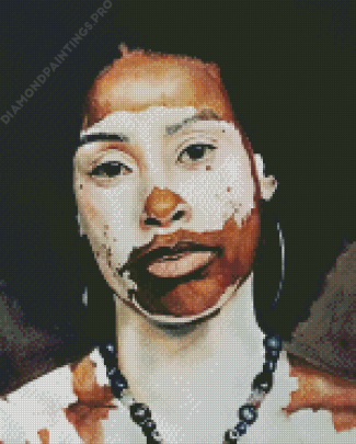 Asian Vitiligo Woman Art Diamond Painting